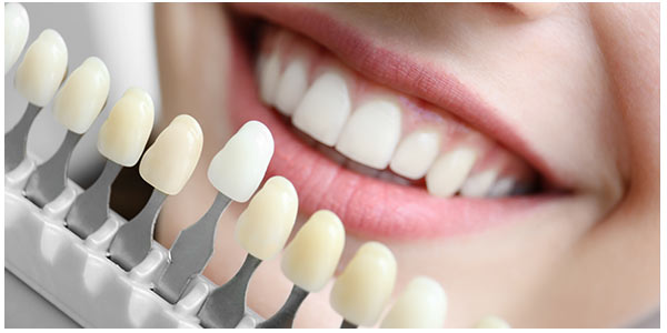 What Is the Cost of Veneers per Tooth Near Me in Stafford, TX