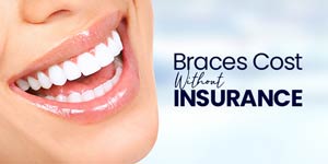 Braces Cost without Insurance Near Me in Stafford TX