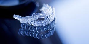 Invisalign vs. Braces for Straightening Your Teeth | Smile Dental